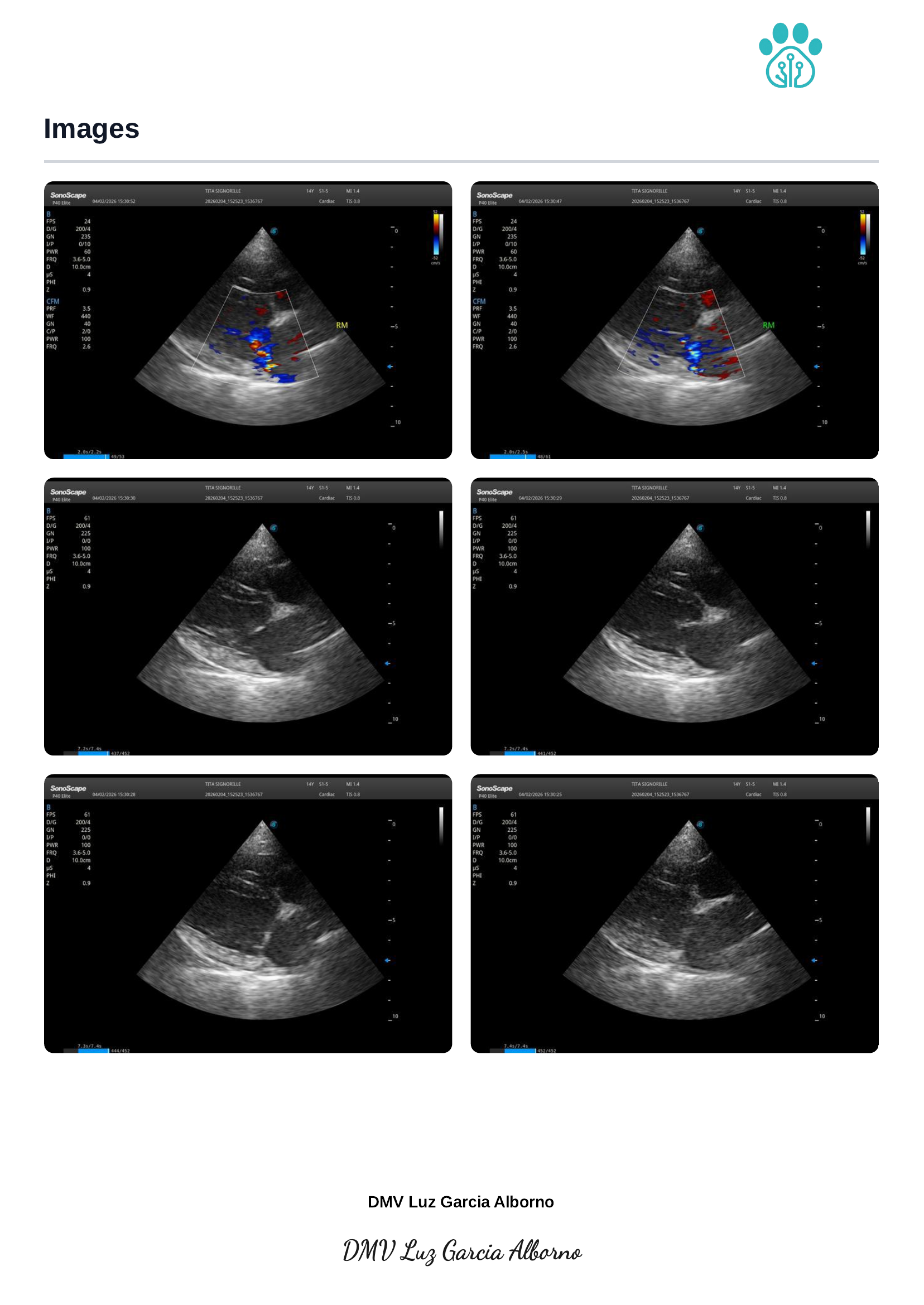 Echocardiography report page 3 of 5