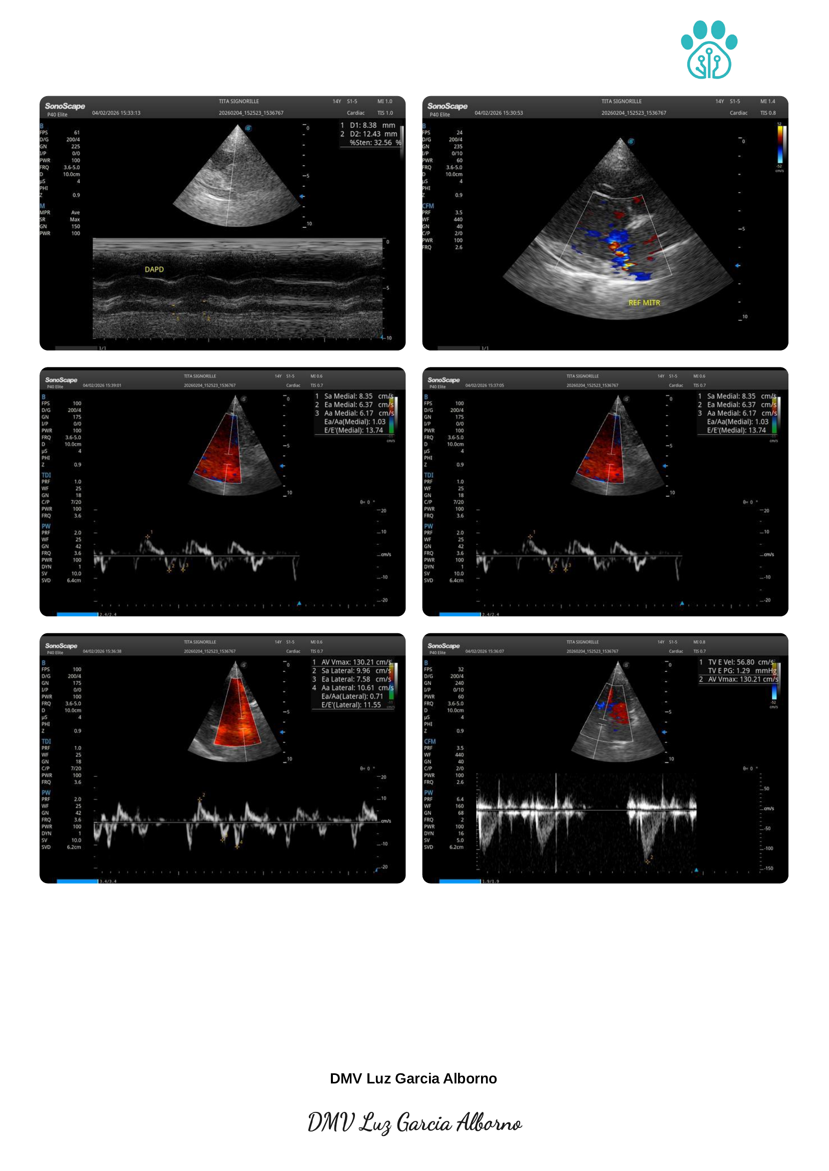 Echocardiography report page 4 of 5